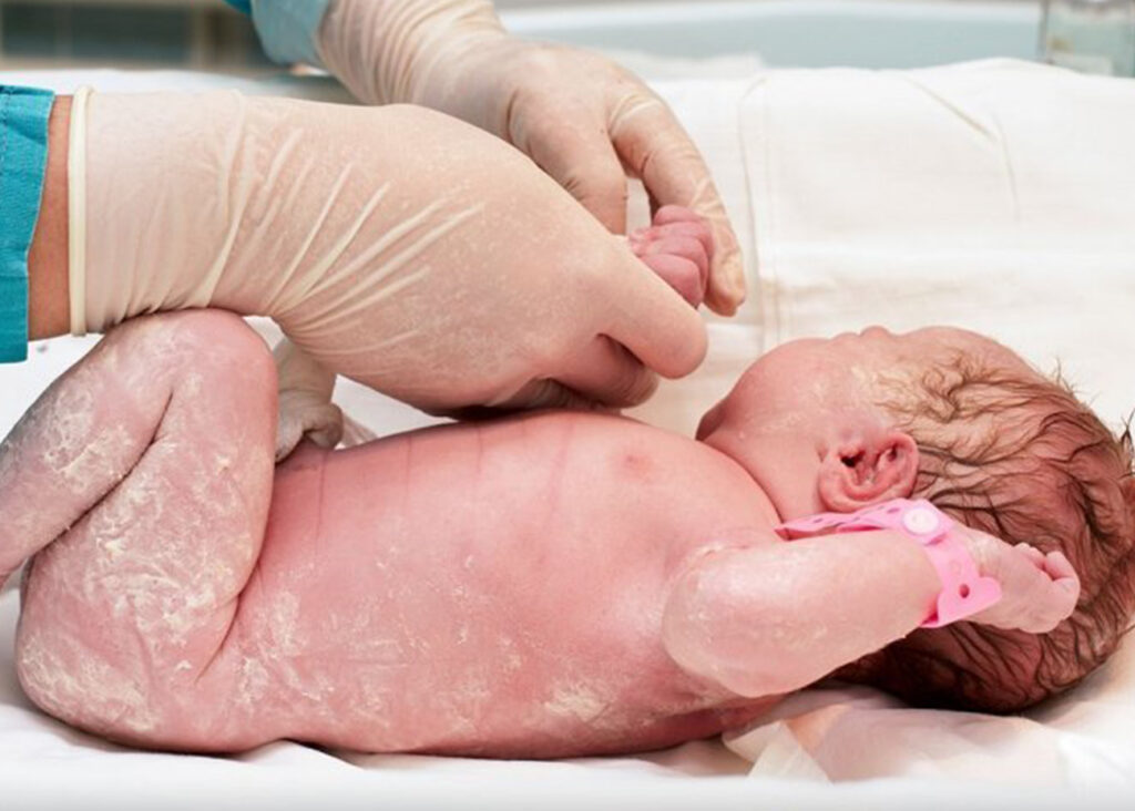 piel-del-recién-nacido-cuidado-piel-pañal-bebe-pediatria-humanizada-doctores-robledo-pediatras-en-monterrey-los-mejorrs-pediatras-especialistas-en-neonatología-pediatria-humanistas