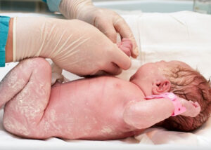 piel-del-recién-nacido-cuidado-piel-pañal-bebe-pediatria-humanizada-doctores-robledo-pediatras-en-monterrey-los-mejorrs-pediatras-especialistas-en-neonatología-pediatria-humanistas